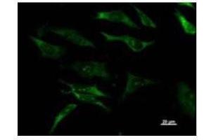 Immunostaining analysis in HeLa cells. (DHX29 抗体)