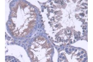 IHC-P analysis of Mouse Testis Tissue, with DAB staining. (OS9 抗体  (AA 471-672))