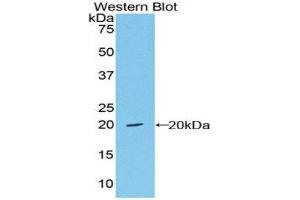 Western Blotting (WB) image for anti-Von Willebrand Factor (VWF) (AA 1498-1665) antibody (Biotin) (ABIN1173732) (VWF 抗体  (AA 1498-1665) (Biotin))