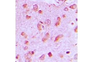 Immunohistochemical analysis of JIP2 staining in human brain formalin fixed paraffin embedded tissue section. (IB2 抗体  (C-Term))