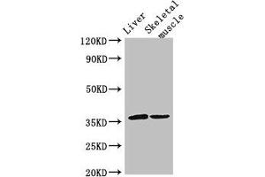 Western Blot Positive WB detected in: Mouse liver tissue, Mouse skeletal muscle tissue All lanes: LYVE1 antibody at 3 μg/mL Secondary Goat polyclonal to rabbit IgG at 1/50000 dilution Predicted band size: 36 kDa Observed band size: 36 kDa (LYVE1 抗体  (AA 20-238))