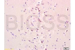 Formalin-fixed and paraffin embedded rat brain tissue labeled with Anti-Galc Polyclonal Antibody, Unconjugated (ABIN708101) at 1:200 followed by conjugation to the secondary antibody, (SP-0023), and DAB staining (GALC 抗体  (AA 301-400))