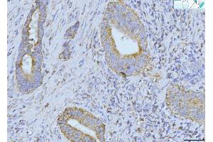 IHC analysis of ETFA using anti-ETFA antibody (ABIN7599281).
