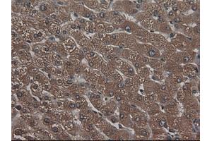 Image no. 1 for anti-Carboxypeptidase A1 (Pancreatic) (CPA1) (AA 1-419) antibody (ABIN1490772) (CPA1 抗体  (AA 1-419))