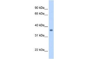 SGCG antibody used at 1. (SGCG 抗体)