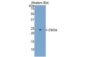 Western Blotting (WB) image for anti-Erythropoietin Receptor (EPOR) (AA 45-244) antibody (ABIN3209698) (EPOR 抗体  (AA 45-244))