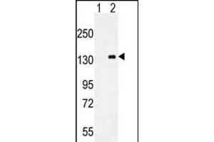 Western blot analysis of CSF1R (arrow) using mouse Monoclonal CSF1R ABIN659076. (CSF1R 抗体)