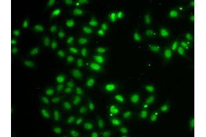 Immunofluorescence analysis of MCF7 cell using DUSP22 antibody. (DUSP22 抗体)