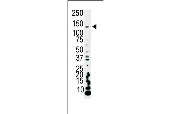 PIK3CA 抗体  (C-Term)