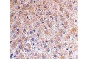 Immunohistochemistry (IHC) image for anti-Tumor Protein P53 Inducible Nuclear Protein 1 (TP53INP1) (N-Term) antibody (ABIN1031500) (TP53INP1 抗体  (N-Term))