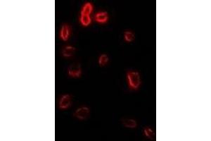 Immunofluorescent analysis of Stomatin staining in Hela cells. (Stomatin 抗体)