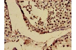 Immunohistochemistry of paraffin-embedded human testis tissue using ABIN7153811 at dilution of 1:100 (USO1 抗体  (AA 591-733))