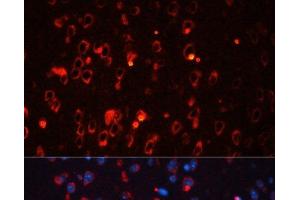 Immunofluorescence (IF) image for anti-Potassium Voltage-Gated Channel, Shaker-Related Subfamily, Member 1 (KCNA1) antibody (ABIN7259450)