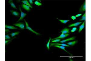 Immunofluorescence of purified MaxPab antibody to HOMER1 on HeLa cell. (HOMER1 抗体  (AA 1-354))