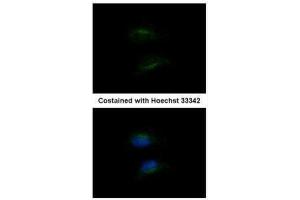 Immunofluorescence (IF) image for anti-Hydroxy-delta-5-Steroid Dehydrogenase, 3 beta- and Steroid delta-Isomerase 2 (HSD3B2) antibody (ABIN2855488)