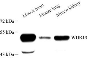 Western blot analysis of WDR13 (ABIN7076212) at dilution of 1: 1000 (WDR13 抗体)