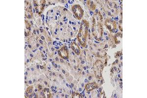 Immunohistochemistry of paraffin-embedded rat kidney using EPXH2 antibody at dilution of 1:200 (x400 lens). (EPHX2 抗体)