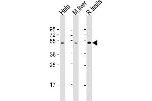 All lanes : Anti-CHRNB2 Antibody (N-Term) at 1:2000 dilution Lane 1: Hela whole cell lysate Lane 2: mouse liver lysate Lane 3: rat testis lysate Lysates/proteins at 20 μg per lane. (CHRNB2 抗体  (AA 66-100))