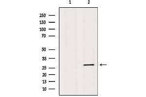 Western blot analysis of extracts from 293, using IBP4 Antibody. (IGFBP4 抗体  (Internal Region))