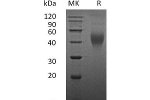 Western Blotting (WB) image for Colony Stimulating Factor 1 (Macrophage) (CSF1) (Active) protein (ABIN7320618) (M-CSF/CSF1 蛋白)