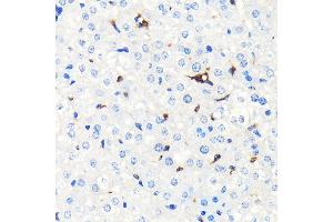 Immunohistochemistry of paraffin-embedded mouse liver using Heme Oxygenase 1 (HO-1/HMOX1) (HO-1/HMOX1) Rabbit mAb  at dilution of 1:100 (40x lens). (HMOX1 抗体)