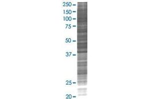 ELA3A transfected lysate. (ELA3A 293T Cell Transient Overexpression Lysate(Denatured))