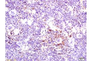 Immunohistochemistry (IHC) image for anti-Tumor Necrosis Factor (Ligand) Superfamily, Member 11 (TNFSF11) (AA 210-317) antibody (ABIN672696)