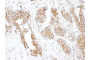 Immunohistochemistry (IHC) image for anti-Chaperonin Containing TCP1, Subunit 5 (Epsilon) (CCT5) (AA 100-150) antibody (ABIN7453616)