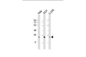 All lanes : Anti-RAB1B Antibody at 1:4000 dilution Lane 1: Hela whole cell lysate Lane 2: A431 whole cell lysate Lane 3: U-20S whole cell lysate Lysates/proteins at 20 μg per lane. (RAB1B 抗体  (AA 1-201))