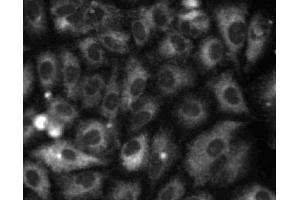 Immunofluorescent staining of A549 (ATCC CCL-185) cells. (Calretinin 抗体  (AA 38-151))
