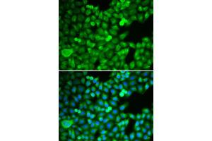 Immunofluorescence analysis of MCF-7 cell using PSMB5 antibody. (PSMB5 抗体  (AA 1-263))