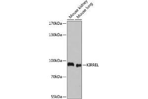 Western blot analysis of extracts of various cell lines, using KIRREL antibody (ABIN7268117) at 1:1000 dilution. (KIRREL 抗体  (AA 17-200))