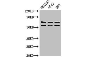 Western Blot Positive WB detected in: HEK293 whole cell lysate, A549 whole cell lysate, U87 whole cell lysate All lanes: CPZ antibody at 3 μg/mL Secondary Goat polyclonal to rabbit IgG at 1/50000 dilution Predicted band size: 74 kDa Observed band size: 74, 59 kDa (CPZ 抗体  (AA 21-652))