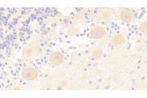 Detection of IRS2 in Human Cerebellum Tissue using Polyclonal Antibody to Insulin Receptor Substrate 2 (IRS2) (IRS2 抗体)