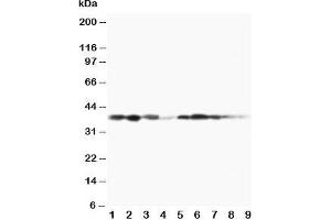 Western blot testing of MEK3 antibody and Lane 1:  rat spleen;  2: rat thymus;  3: rat skeletal muscle;  4: rat kidney, and human samples  5: MCF-7;  6: HeLa;  7: Raji;  8: CEM;  9: COLO320 cell lysate (MAP2K3 抗体  (C-Term))