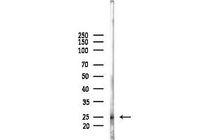 anti-TGFB-Induced Factor Homeobox 2-Like, X-Linked (TGIF2LX) antibody