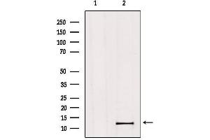 Western blot analysis of extracts from Hela, using MED11 Antibody. (MED11 抗体  (Internal Region))