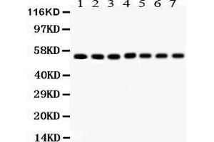 Anti- SMAD Picoband antibody, Western blotting All lanes: Anti SMAD  at 0.