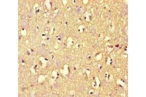 Immunohistochemistry of paraffin-embedded human brain tissue using ABIN7167960 at dilution of 1:100 (ARHGAP42 抗体  (AA 541-728))