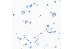 Immunocytochemistry (ICC) image for anti-Bromodomain Containing 9 (BRD9) (AA 547-597) antibody (ABIN7455162)