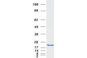 Western Blotting (WB) image for Centrin, EF-Hand Protein, 1 (CETN1) protein (Myc-DYKDDDDK Tag) (ABIN2713916)