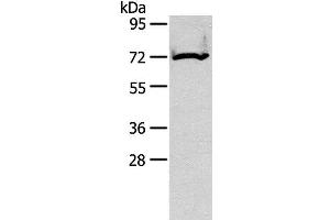 Western Blot analysis of Mouse kidney tissue using CPT2 Polyclonal Antibody at dilution of 1:200 (CPT2 抗体)