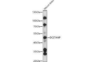 Western blot analysis of extracts of Mouse brain, using DCSTAMP antibody (ABIN7270939) at 1:3000 dilution. (Transmembrane 7 Superfamily Member 4 (TM7SF4) (AA 401-470) 抗体)