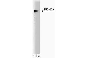 Western blot analysis of Clathrin Heavy Chain on HeLa cell lysate (center). (Clathrin 抗体  (AA 4-171))