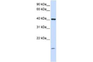 TMEM79 antibody used at 1 ug/ml to detect target protein. (TMEM79 抗体  (C-Term))