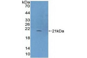 Detection of Recombinant PLCb3, Human using Polyclonal Antibody to Phospholipase C Beta 3, Phosphoinositide Specific (PLCb3) (Phospholipase C beta 3, Phosphoinositide Specific (AA 318-468) 抗体)