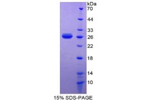 SDS-PAGE (SDS) image for Leukocyte Cell Derived Chemotaxin 1 (LECT1) (AA 134-334) protein (His tag) (ABIN1981091)