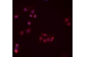 ABIN6277454 staining Hela cells by IF/ICC. (PPP2CB 抗体  (C-Term))