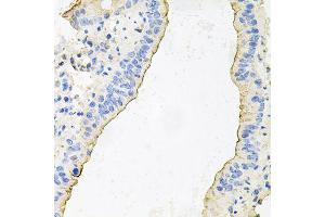 Immunohistochemistry of paraffin-embedded mouse lung using HPR antibody (ABIN6003630) at dilution of 1/100 (40x lens). (HPR 抗体)