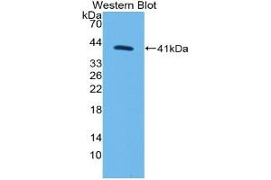 Detection of Recombinant MYO5A, Human using Polyclonal Antibody to Myosin VA (MYO5A) (MYO5A 抗体  (AA 1531-1855))